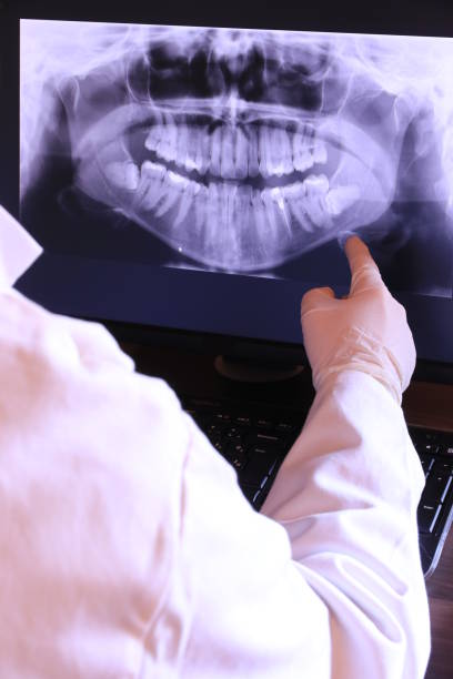 Best Emergency Root Canal Treatment in Stoughton, WI