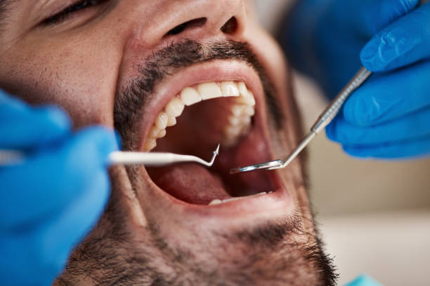 Best Emergency Treatment for Toothache in Stoughton, WI